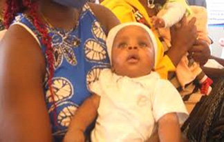 Campagne de vaccination contre la Poliomyelite à l’hôtipal Adlucem de Bonamoussadi à Douala